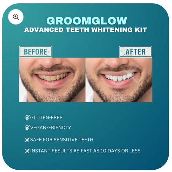 Groom Glow Teeth Whitening Kit - New and Unopened - Picture 7 of 7